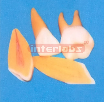 SERIES OF TEETH,3 PCS/SET